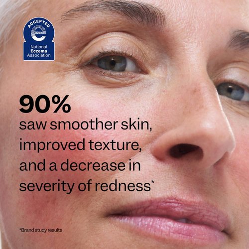 Peach Slices - 10% Azelaic Acid Serum for Redness Relief | Advanced Vegan Skincare (1.01 oz)