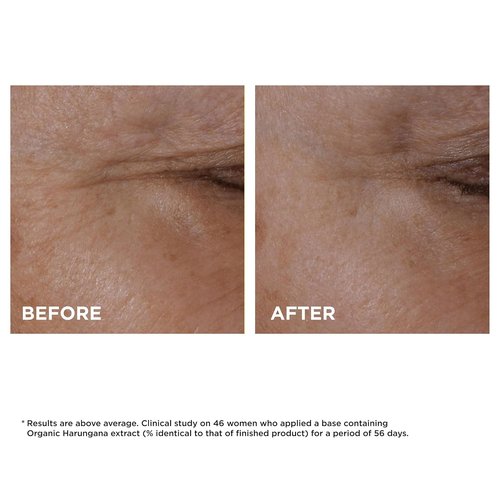 Clarins Total Lift Eye Concentrate - High-Performance Lifting Formula | 0.5 Fl Oz