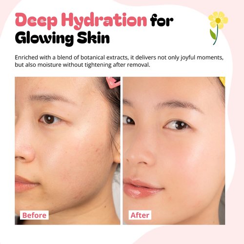 Epielle Rabbit Character Face Masks - Fun Korean Skin Care for Spa Parties | 6 Pack Ideal for Gifts
