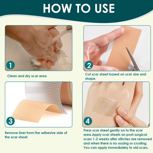 Silicone Scar Tape (1.6"x 120" Roll-3M), Premium Silicone Gel Scar Sheets, Reusable Silicone Patches, Soft Silicone Tape for Surgeries Scars, C-Sections, Wrinkles et