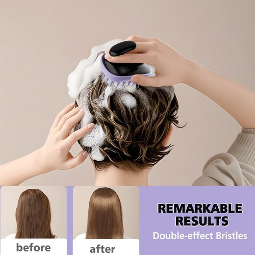 Skiennix 2-in-1 Scalp Massager Shampoo Brush - Exfoliator for Dandruff & Hair Growth | Black Purple