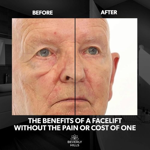 Beverly Hills Men's Instant Facelift Eye Serum - Reduces Dark Circles & Puffy Eyes | Anti-Wrinkle Treatment