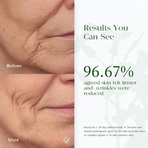 MATRÚM Organic Anti Aging Face Oil, 100% Natural Hydrating Brightening Serum, Squalane + Sea Buckthorn + Rosehip Oil, Vitamin E, Retinol, Antioxidant Gua Sha Oil for Sensitive & Dry Skin