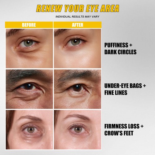 Instant Eye Tightener Cream | Reduces the Appearance of Under-Eye Bags, Puffiness, Dark Circles & Fine Lines | Lightweight, Non-Greasy & No White Cast | Smooth Application & Makeup-Friendly (1 PCS)
