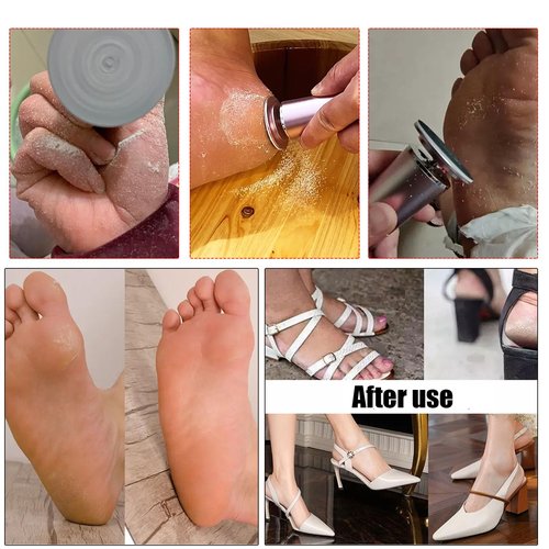 Electric Foot File Callus Remover Professional Foot Sander Grinder Scrubber Foot File Pedicure Tools Adjustable Speed 60 Replacement Sandpaper disc Easy to Remove Cutin Dead Skin calluses-Rose Gold