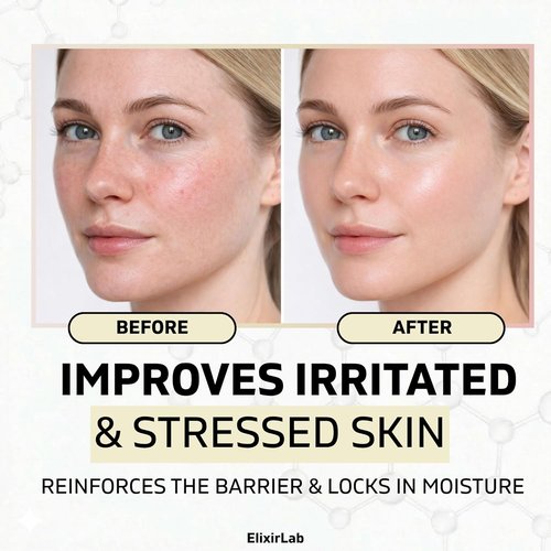 Ectoin Cream 10,000ppm - Korean Barrier Repair Moisturizer with Panthenol & Niacinamide | Fragrance-Free for Sensitive Skin | 1.69 fl oz