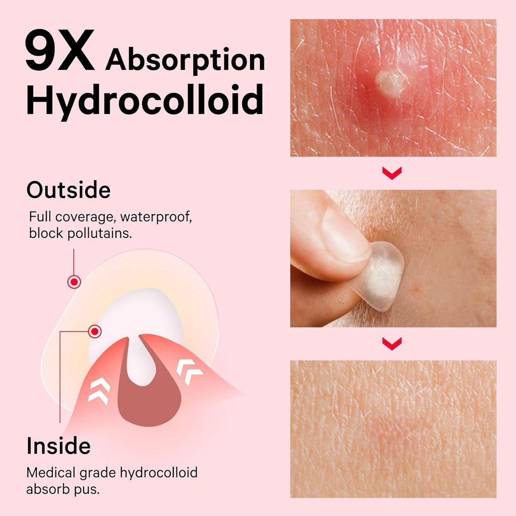 Sosky Pimple Patches - Invisible Hydrocolloid Acne Stickers with Salicylic Acid | 48 Count for Clear Skin