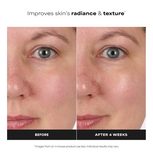Paula's Choice SKIN BALANCING Toner - Pore-Reducing Formula with Niacinamide for Oily & Combination Skin | Hydrates & Controls Shine