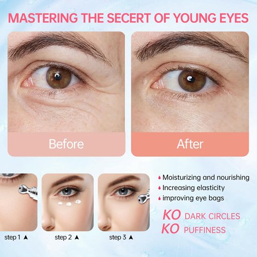 Instant Reduction of Eye Bags-Retinol Eye Cream Dark circles,Relieves Dark Circles And Puffiness, Youth Eye Cream: Smooth Wrinkles,Hydrating, Tightens The Delicate Skin Under The Eyes 0.7 OZ -PPP