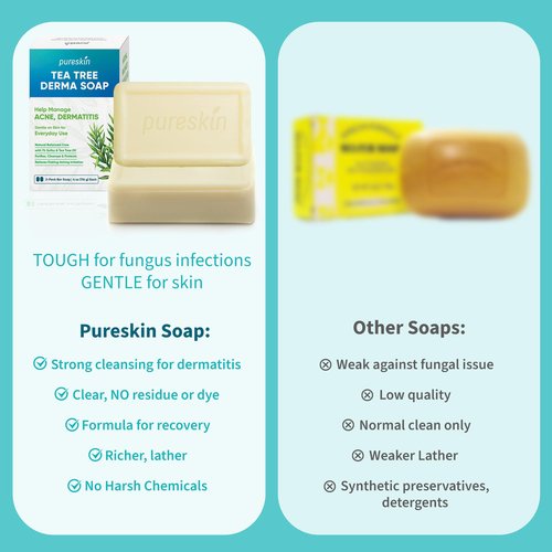 PURESKIN Sulfur & Tea-Tree-Oil Soap Bar: Natural Balanced Cleansing for Oily, Acne Dermatitis-Prone & Irritated Skin – Helps Reduce Body Odor & Blemishes – 2 Pack