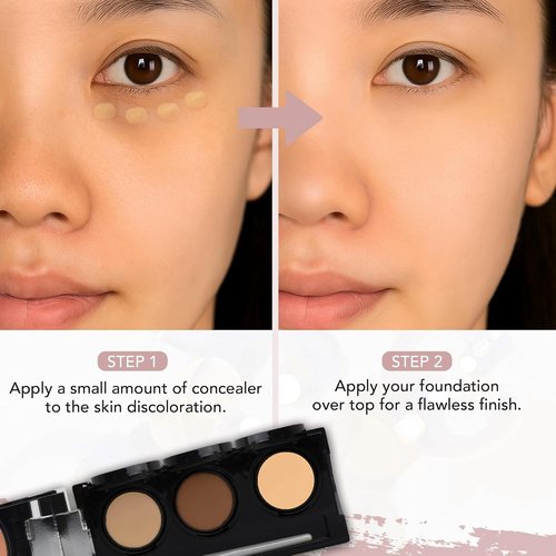 Dermaflage Waterproof Concealer Palette - Full Coverage Matte Finish for Face & Body | Hides Dark Circles & Acne, Medium