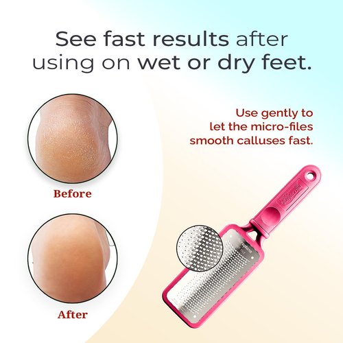 Microplane Colossal Foot File - Original Stainless Steel Callus Remover & Gentle Foot Scrubber | Pink Pedicure Tool