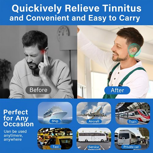 TEELAMP Tinnitus Relief for Ringing Ears, Tinnitus Relief Patch Natural & Long-Lasting Comfort, Effective Reduce Ear Noise, Tinitus Ringing & Discomfort, Mild Ingredients Safe for Daily Use, 60 Pcs