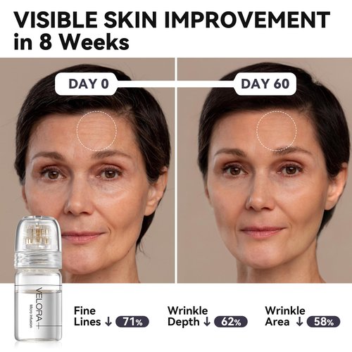 VELORA Micro Infusion System for Face - Hydrating Peptide & Hyaluronic Acid Serum Set, Skin-Smoothing Radiance Set with 0.25mm Stamp, At-Home Facial Kit, 1-Month Supply