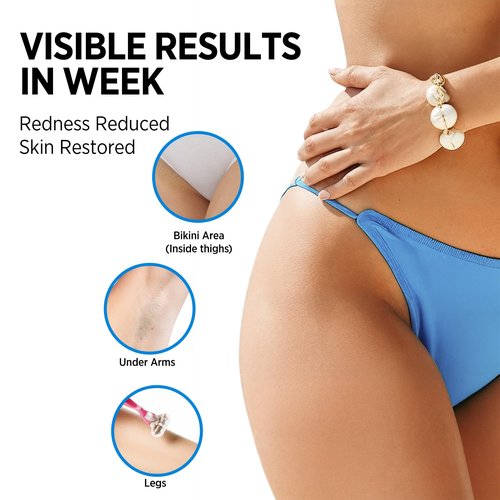 Metyou Ingrown Hair Treatment Oil for Women: V Soothes Redness & Prevents Razor Bumps - After Shave Treatment Oil for Bikini Area, Legs, Underarm and Arm - 80ML