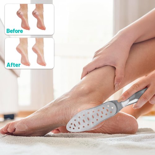 Foot File Callus Remover Stainless Steel Double Sided Foot Scraper, Foot Rasp for Dry and Wet Skin, Pedicure Tool for Feet Hard Skin and Cracked Heels