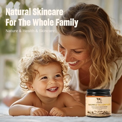 CADDISE Whipped Beef Tallow for Skin – 100% Grass-Fed Handmade Cream Moisturizer for Face & Body, Natural with Honey, Shea Butter, Jojoba Oil, Non-Greasy, Nourishing for Men, Women, Kids, 4 Oz