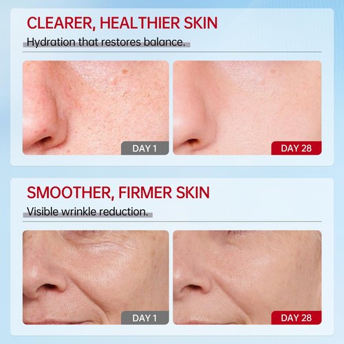 VGO Snail Mucin 92% Moisturizer Daily Face Moisturizer Hydrating Repair Face Gel Cream for Dry & Sensitive Skin, All Skin Types 50g / 1.76oz