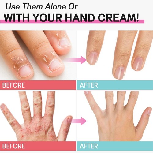 Moisturizing Glovers,Gel Spa Glovers,Soft Moisturizing Gel Lining Infused with Essential Oils and Vitamins for Repairing and Softening Dry Cracked Hand Skins.