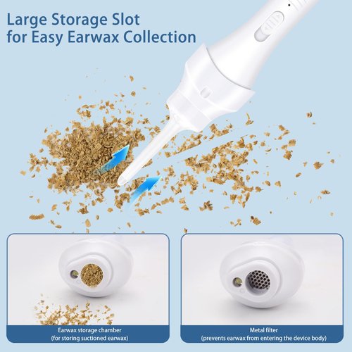 Ear Wax Removal Kit with Ear Vacuum, LED Ear Cleaner Tool, Soft Silicone Spoon, 3 Tips and Vacuum Head, Rechargeable & Easy to Clean (Ceramic White)