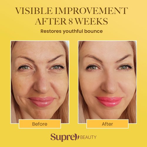 SupreH Bee Venom Cream Wrinkle Filler: Instant Face Lift Cream and Eye Tightener Cream with Hyaluronic acid Niacinamide for women and men 50 ML
