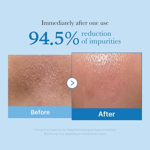 Medicube Zero Pore Blackhead Cleansing Oil - Gentle Makeup Remover & Daily Moisturizer | Korean Skin Care (205ml / 6.93 fl. oz)