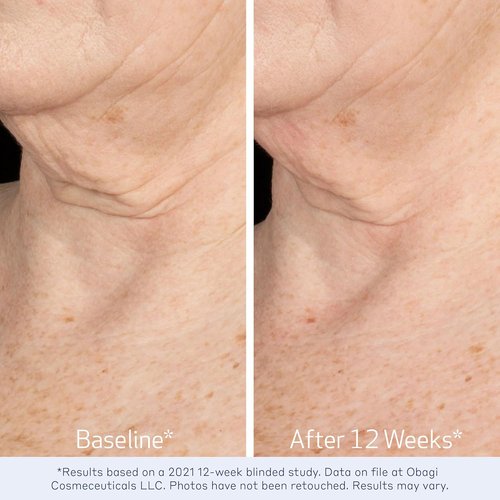 Obagi ELASTIderm Neck & Décolleté Lifting Concentrate - Reduce Fine Lines & Wrinkles | 2 oz