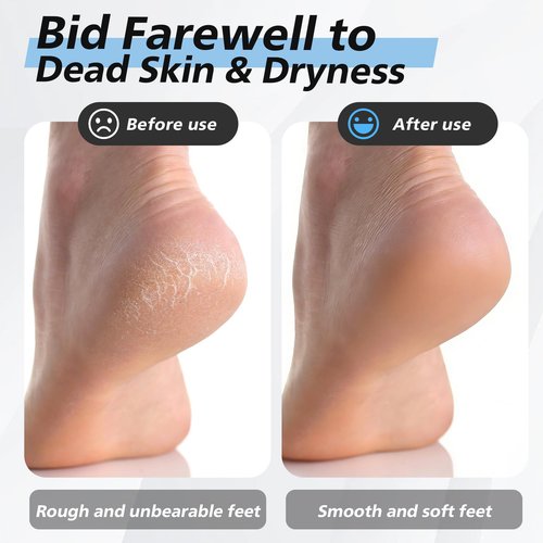 BALUCA Nano Glass Foot File Callus Remover for Feet - Glass Foot Scraper Scrubber Dead Skin Removal for Cracked Heels,Professional Pedicure Tool for Home, Salon, and Travel (Blue)