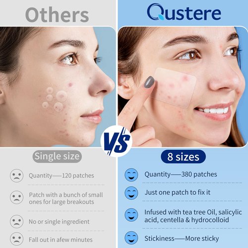 QUSTERE Large Pimple Patches for Face, Hydrocolloid Acne Patches, Big Hydrocolloid Bandages, Variety Shapes Zit Covers, Stickers with Tea Tree, Salicylic Acid & Cica Oil |8 Sizes |380 Count