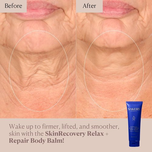 Nakery SkinRecovery Magnesium Balm - Relaxing Skin Tightening Cream with SepiLift & Retinol | Hydrating Muscle Balm with Melatonin for Restful Sleep