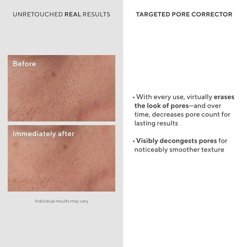 Murad Targeted Pore Corrector - Bio-Tech Copper & Amino Acid Treatment for Instant Pore Minimization | 0.5 Fl Oz