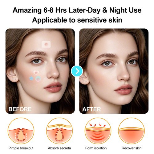 Pimple Patches for Face, Various styles, colors, Large Hydrocolloid Pimple Patches, 150 Count Pimple Patche, Good for blemishes with a head and visible gunk, With a Cute mirror case