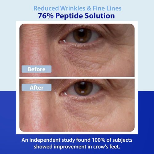 Dr. Denese Wrinkle RX Peptide Solution Concentrate 1 oz - Lightweight Hydration for Smoother, Firmer Skin
