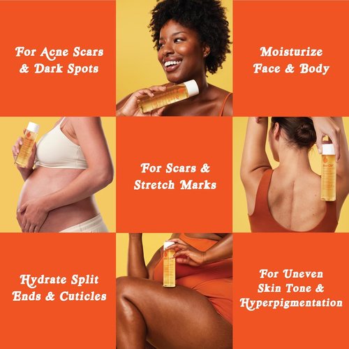 Bio-Oil Natural Skincare Oil - Serum for Scars & Stretch Marks | Moisturizer for All Skin Types, 6.7 Oz