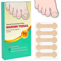 Ingrown Toenail Treatment, 60 Pcs Breathablless Toenail Suppore and Foot Care, Toenail Corrector Patch