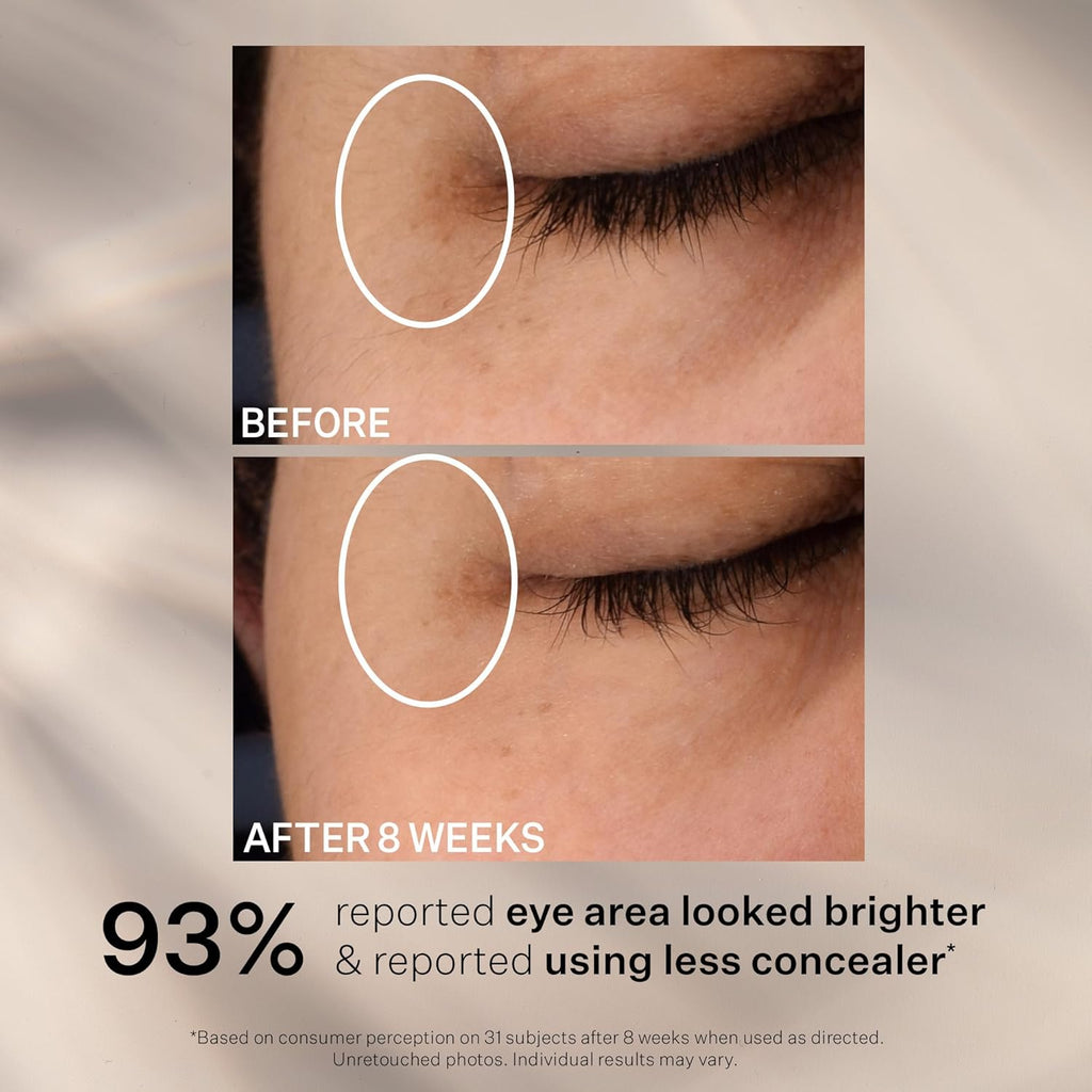 StriVectin Super-C Eye Cream - Brightening & Firming Formula with Hyaluronic Acid | 0.5 oz