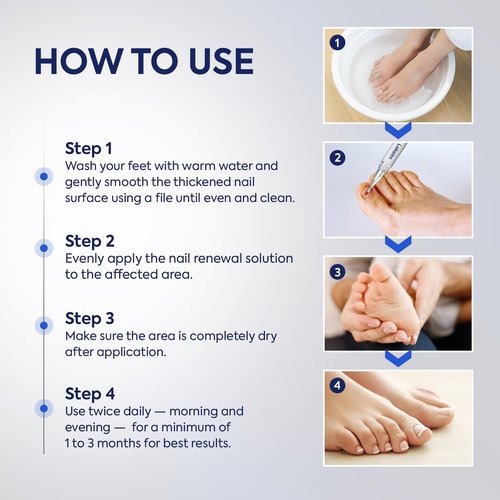 Toenail Fungus Treatment Extra Strength: 25% Undecylenic Acid & Tea Tree Oil - Repairs Yellow Thick Brittle Toe and Fingernails - 3 Pens with 5 Nail Files