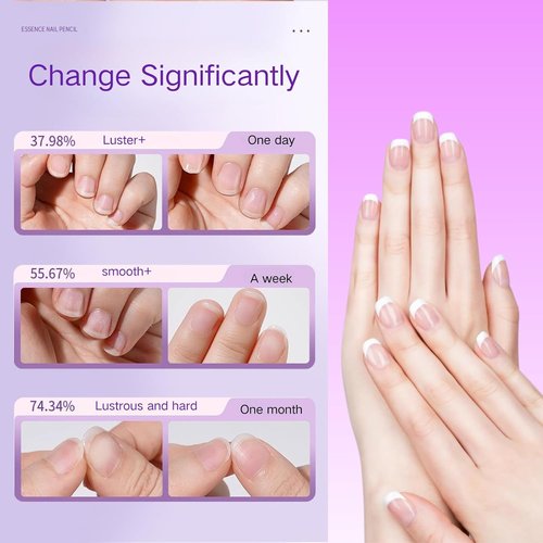 Skiennix 3-in-1 Cuticle Oil Pen - New Ceramic Tip Nail Care Tool for Hangnails & Moisturizing (1pc)