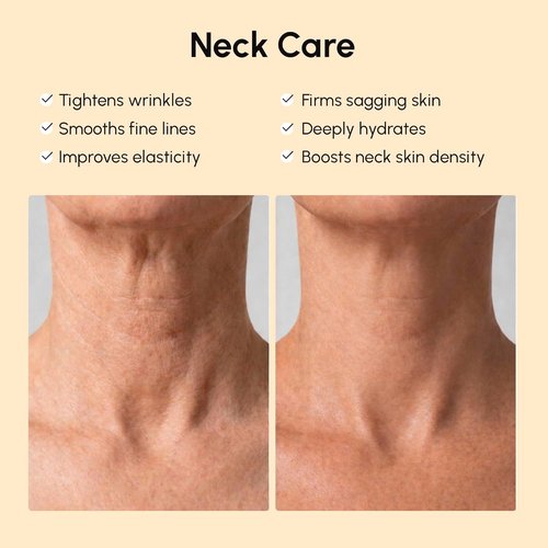 MAREE Neck Wrinkle Patches - Collagen Anti-Wrinkle Treatment with Retinol & Hyaluronic Acid - 5 Pcs