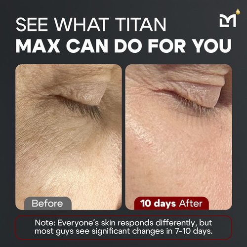 Man Labs Titan MAX Anti-Aging Face Serum for Men - Ultra Potency Skin Tightening Cream with Vitamin C & E, 10% Niacinamide, Hyaluronic Acid - Unscented