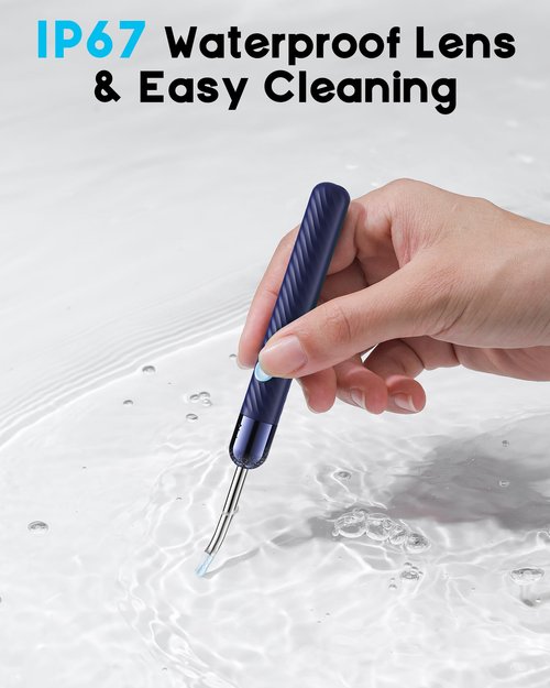 Loyker Ear Wax Removal, Ear Cleaner with Camera with 1080P, Otoscope with Light, Ear Wax Removal Kit with 6 Ear Pick, Ear Camera for iPhone, iPad, Android Phones (Blue)