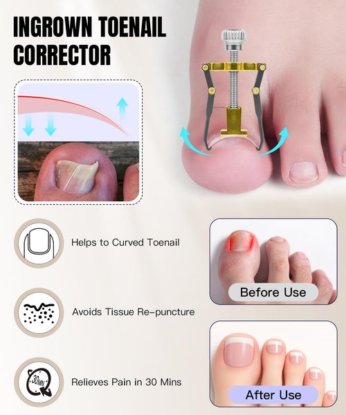 Toenail Clippers for Thick Nails - Ingrown Toenail Removal Kit - 12Pcs Podiatrist Grade Toe Nail Clippers for Seniors Men Women - Professional Home Pedicure Tools for Feet