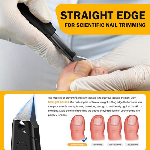 BEZOX Ingrown Toenail Clippers for Seniors, Slant Straight Blade Toe Nail Clippers for Thick and Ingrown Nails, Soft Grip Long Handle Toenail Scissors for Mani & Pedi Nail Care - Black