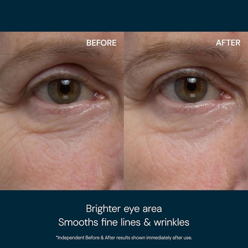 ELEMIS Pro-Collagen Eye Revive Mask - Anti-Wrinkle Treatment That Brightens & Hydrates for Youthful Eyes