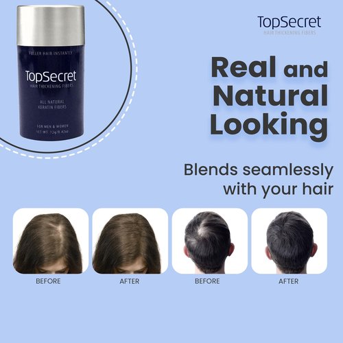 Top Secret Hair Thickening Building Fibers Refills - Undetectable & Natural Hair Filler - for Men & Women - Instantly Fill In Fine Thinning Hair - Weather & Sweat Resistant (Medium Brown, Large)