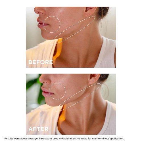 Clarins V-Facial Intensive Wrap Face Mask - Award-Winning Contouring Mask for Puffiness Relief | 2.5 Oz