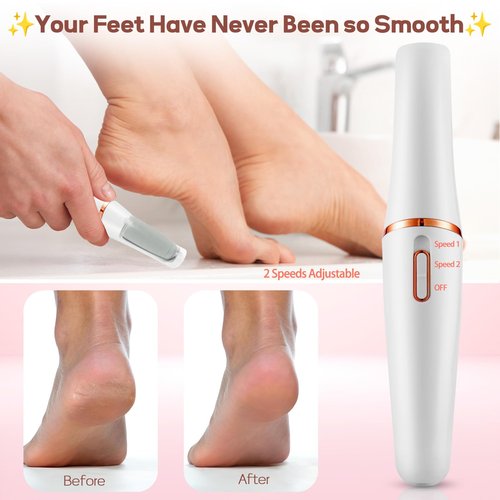 Electric Foot Callus Remover, ZABOUL Electric Foot File Callus Remover Rechargeable Portable Pedicure Tool Kit, Smooth Pedicure Wand for Feet Care, Removes Dry Hard & Dead Skin Ideal Gift (White)