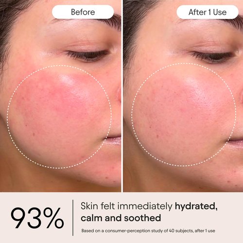 Alpyn Super Peptide & Ghostberry Moisturizer for Eczema, Barrier & Wrinkle Repair | Calm & Soothe Against Redness & Irritation | 1.7 oz / 50 ml