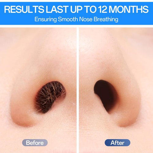NAISIGOO Nose Wax Sticks (60 Pcs) - Dual-Head Wax Hair Removal Applicator for Nostril, Ear, Eyebrow & Upper Lip, Painless, Disposable Waxing Sticks for Men & Women