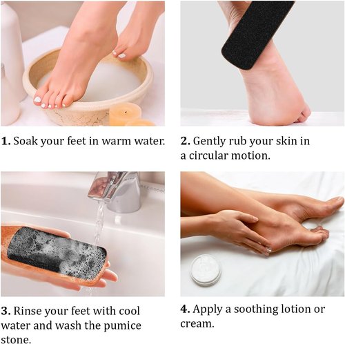 Skiennix Foot File - Double-Sided Pumice Stone Callus Remover for Dry Skin & Cracked Heels